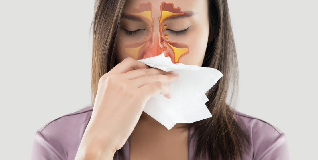 Young woman with chronic rhinitis.